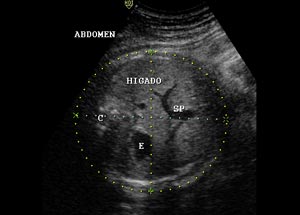 ultrasonido de 40 semanas de embarazo